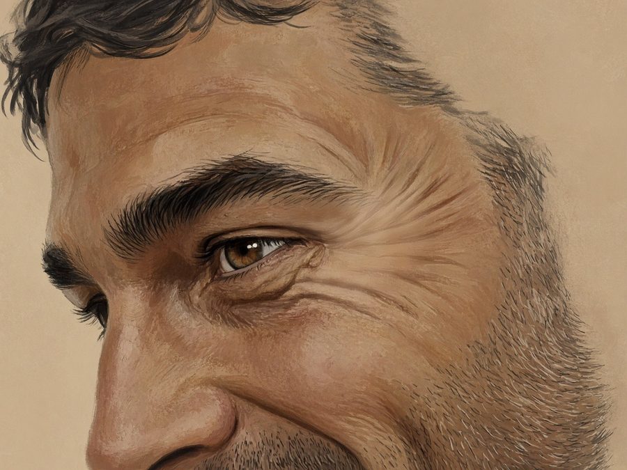 Illustration après, vers J15 : pattes d'oie au coin externe de l'œil adoucies, expression conservée, homme, 45-50 ans (même illustration retouchée)